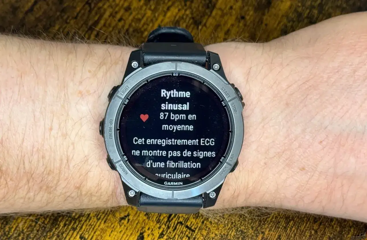 Montre Garmin affichant un rythme sinusal normal &agrave; 87 bpm, sans signes de fibrillation auriculaire sur l'enregistrement ECG.